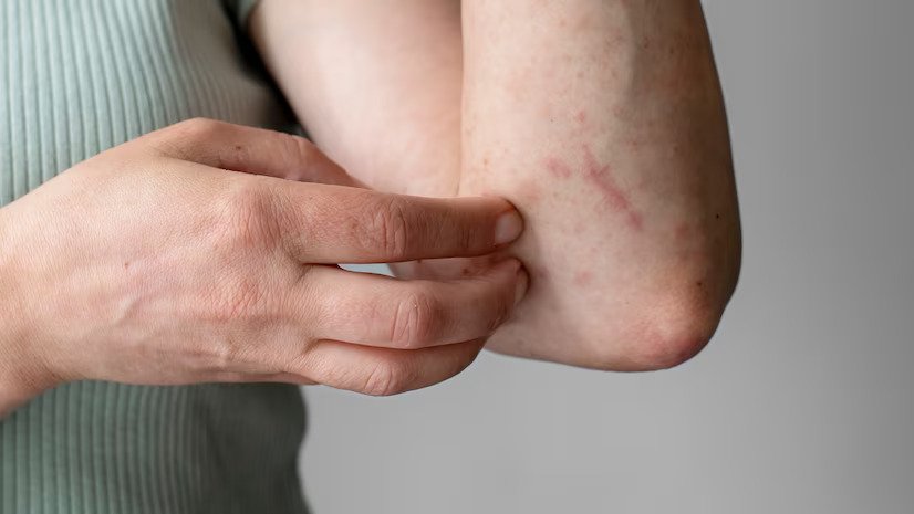 Systemic Autoimmune Diseases